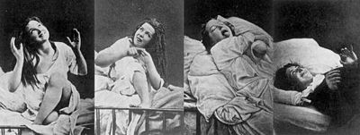 Victorian woman with ‘hysteria’